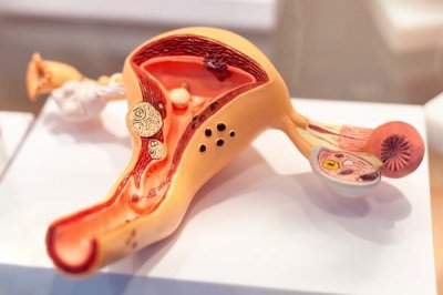 Qadın cinsiyyət üzvlərinin iltihabi xəstəlikləri nədir?